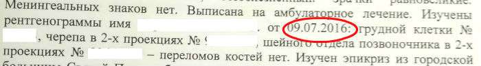 7000 долларов за переломы и пневмоторакс, которые появились через 13 дней после аварии. История ДТП